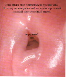 рис.4а рис.4а